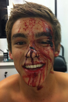 actor brenton thwaites fake injury